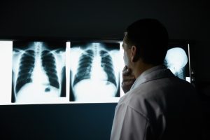 A doctor observes chest X-rays in a dark room.